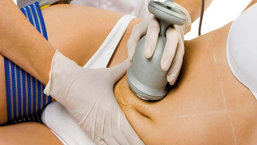 Radyo frekanslı termokoagülasyon