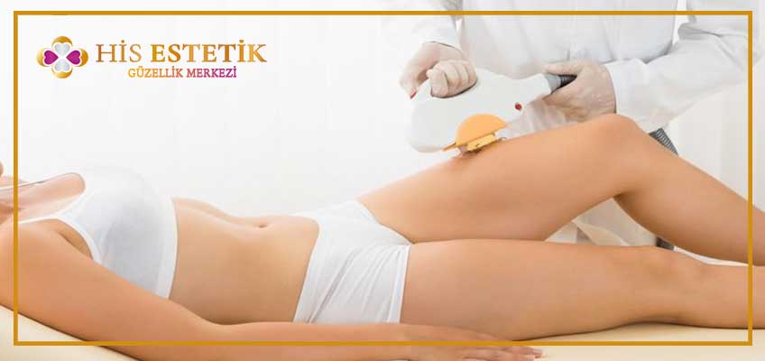bacak lazer epilasyon acıtır mı