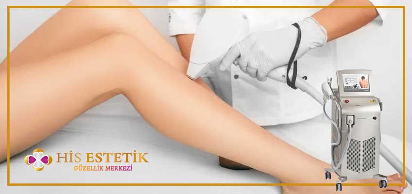 bacak lazer epilasyon