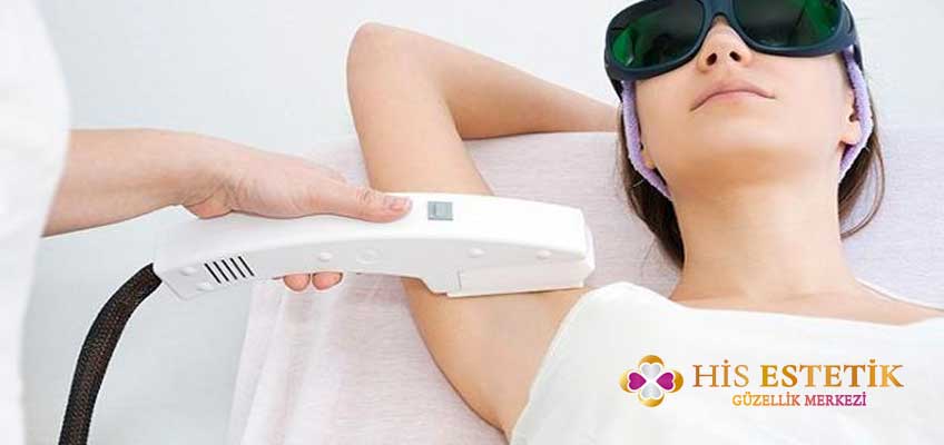 buz lazer epilasyon
