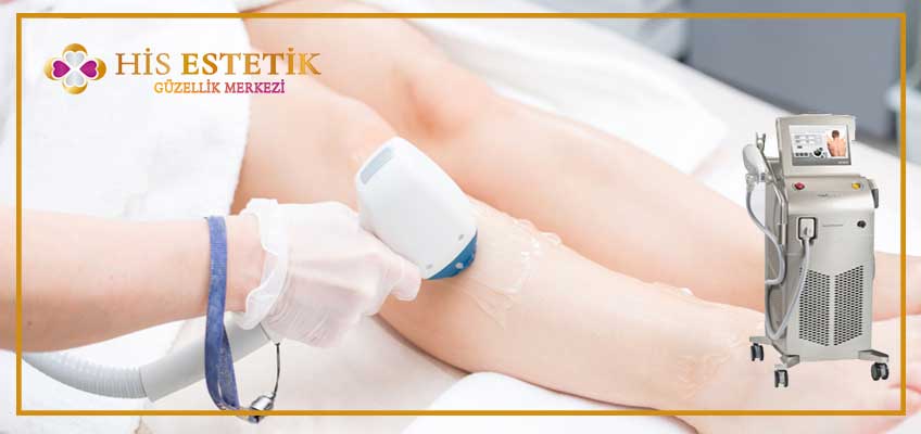 üst bacak lazer epilasyon