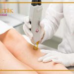 Alexandrite Lazer Epilasyon