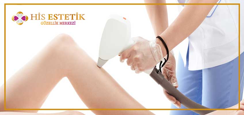 tüm vücut lazer epilasyon