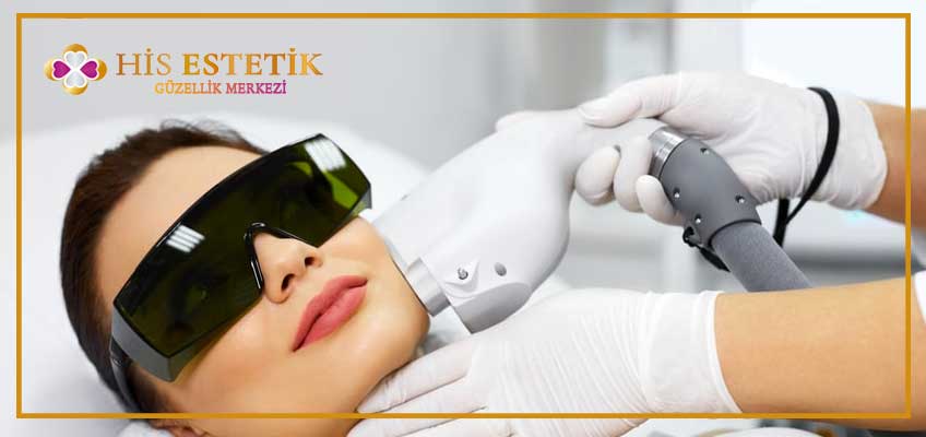 Soprano Buz Lazerin Sağladığı Avantajlar Nelerdir