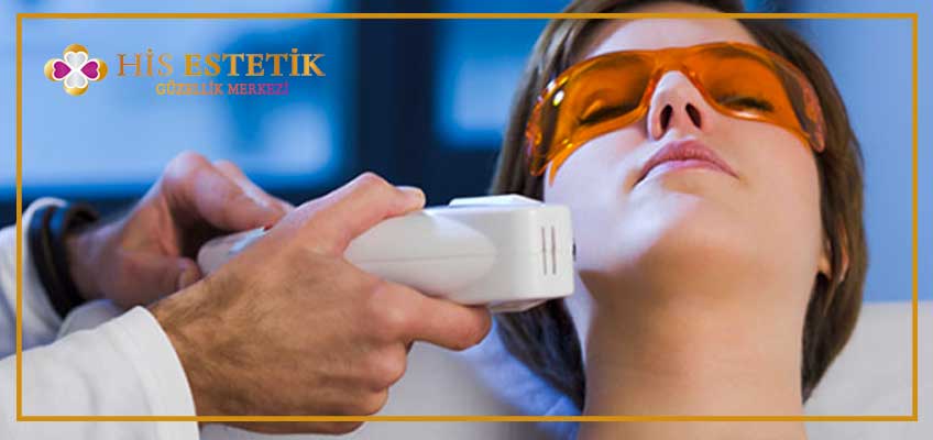 Soprano Lazer Epilasyon