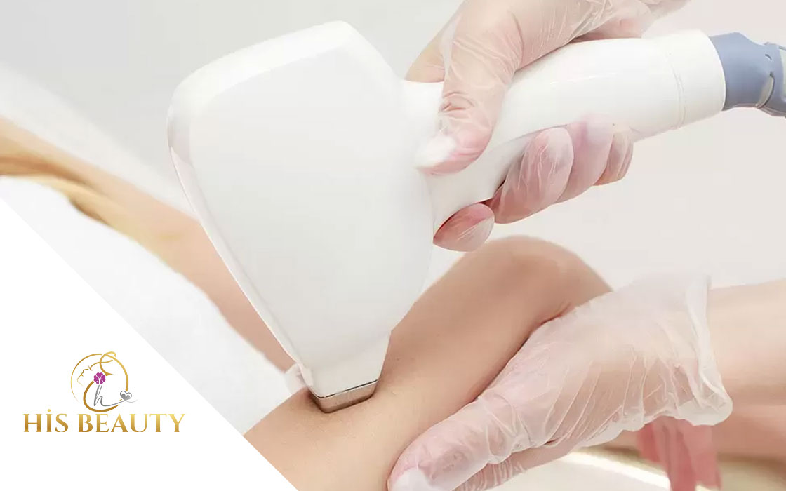 Yarım Kol Lazer Epilasyon